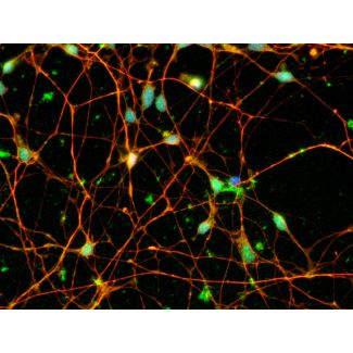 Human Pluripotent Stem Cell derived-Dopaminergic Neurons, immunostained for beta tubulin III (red) and tyrosine hydroxylase (green) 400X