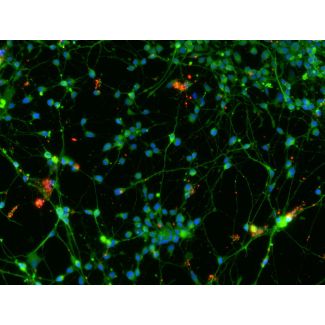 Human Pluripotent Stem Cell derived-Glutamatergic Neurons immunostained for vGLUT1 (red) and beta tubulin III (green) 200X