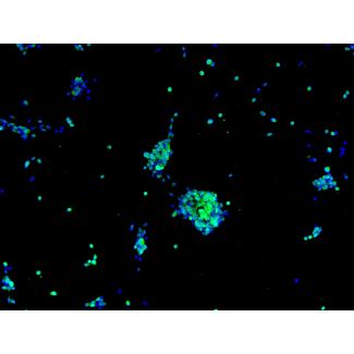 Human Pluripotent Stem Cell derived-Motor Neurons (HPSC-MN) - immunostained for Mnx1 (green) 100X