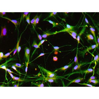 Human Pluripotent Stem Cell derived-Schwann Cells, immunostained for GFAP (red) and S100β (green) 200X