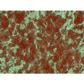 Human Preadipocytes-visceral (HPA-v) - Intracellular lipid droplets are visible after differentiation by Oil Red O staining, 400x.