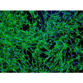 Human Prostate Fibroblasts (HPrF) - Immunostaining for Fibronectin, 100x.