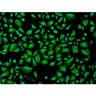Human Pulmonary Alveolar Epithelial Cells (HPAEpiC) - Immunostaining for CK-18, 100x.
