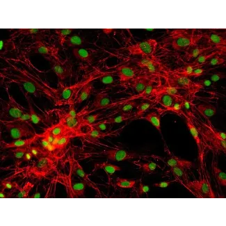 Human Pulmonary Fibroblasts-adult (HPF) - Immunostaining for Fibronectin, 200x.
