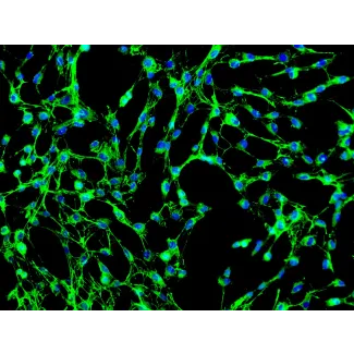 Human Pulmonary Fibroblasts (HPF) - Immunostaining for Fibronectin, 200x.
