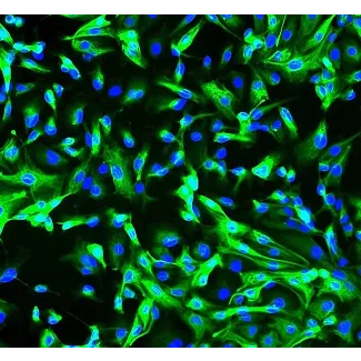 Human Renal Coritcal Epithelial Cells (HRCEpiC) - Immunostaining for CK-18, 200x.
