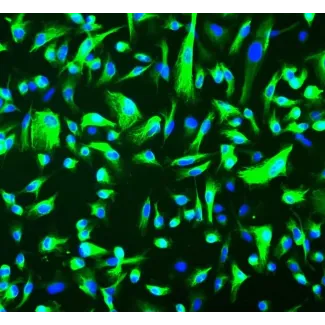 Human Renal Epithelial Cells (HREpiC) - Immunostaining for CK-18, 200x.
