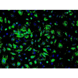 Human Renal Glomerular Endothelial Cells (HRGEC) - Immunostaining for vWF, 200x.
