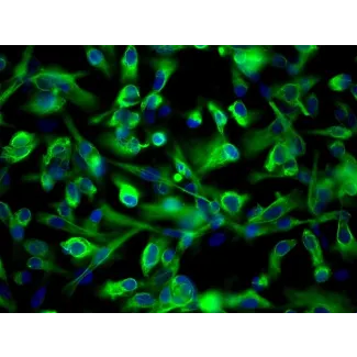 Human Renal Proximal Tubular Epithelial Cells (HRPTEpiC) - Immunostaining for CK-18, 200x.
