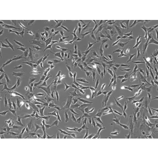 Human Retinal Astrocytes (HRA) - Phase contrast, 100x.
