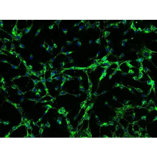 Human Scalp Fibroblasts-fetal (HScF-f) - Immunostaining for Fibronectin, 200x.
