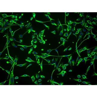 Human Schwann Cells (HSC) - Immunostaining for S100-β, 200x.
