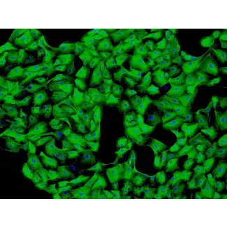 Human Seminal Vesicle Epithelial Cells (HSVEpiC) - Immunostaining for CK-18, 100x.
