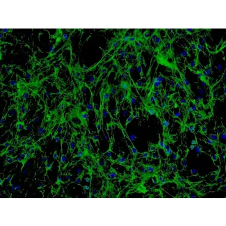 Human Seminal Vesicle Fibroblasts (HSVF) - Immunostaining for Fibronectin, 200x.

