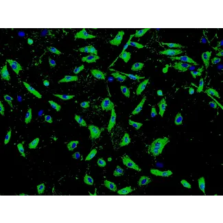 Human Seminal Vesicle Microvascular Endothelial Cells (HSVMEC) - Immunostaining for vWF, 100x.
