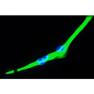 Human Skeletal Muscle Cells (HSkMC) - Immunostaining for Myosin, 400x.
