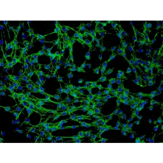 Human Thymic Fibroblasts (HTyF) - Immunostaining for Fibronectin, 200x.
