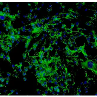 Human Thyroid Fibroblasts (HThF) - Immunostaining for Fibronectin, 200x.
