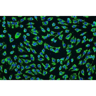 Human Umbilical Artery Endothelial Cells (HUAEC) - Immunostaining for vWF, 200x.
