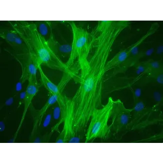 Human Umbilical Vein Smooth Muscle Cells (HUVSMC) - Immunostaining for α-SMA, 400x.
