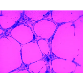 In Vitro Tube Formation Assay
