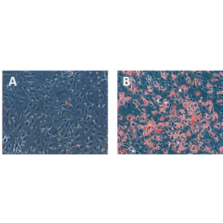 Hepatocytes were either left untreated (A) or treated with 200 μM oleic acid (B). The treated cells exhibited a significant accumulation of lipid droplets, as evidenced by the abundant presence of red dots observed through Oil Red O staining(B).