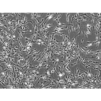 Mouse Astrocytes (MA) - Phase contrast, 100x.
