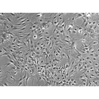 Mouse Astrocytes-hippocampal (MA-h) - Phase contrast, 100x.
