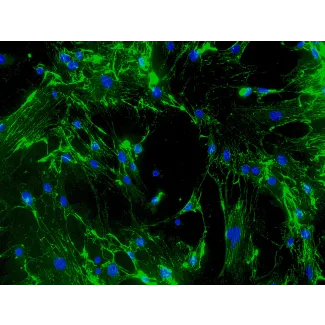 Mouse Cardiac Fibroblasts (MCF) - Immunostaining for Fibronectin, 200x.