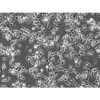 Mouse Cerebellar Granule Cells (MGC) - Phase contrast, 200x.

