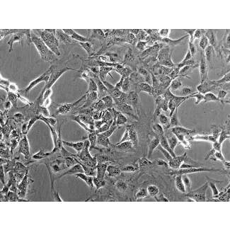 Mouse Meningeal Cells (MMenC) - Phase contrast, 200x.
