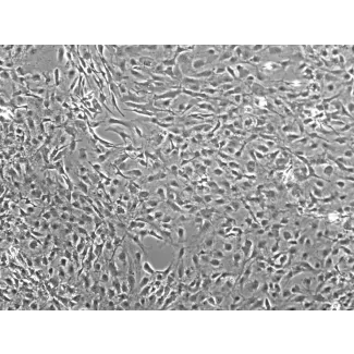 Mouse Meningeal Cells (MMenC) - Phase contrast, 100x.
