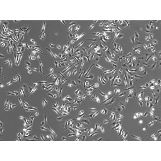 Phase Contrast Caption: Mouse Microglia (MM)- Phase Contrast, 100x
