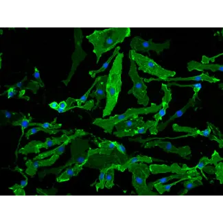 Mouse Microglia (MM) – Immunostaining for F4/80, 200x.
