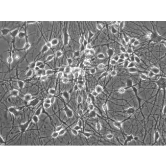 Mouse Neurons-cortical (MN-c) - Phase contrast, 400x.
