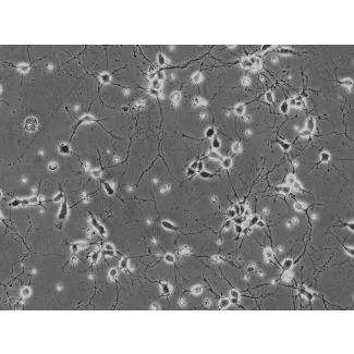 Mouse Neurons-hippocampal (MN-h) - Phase contrast, 200x.
