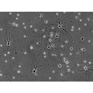 Mouse Neurons-spinal cord (MN-sc) - Phase contrast, 200x.

