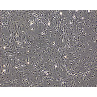 Mouse Pituitary Cells (MPC)-Phase Contrast, 100X
