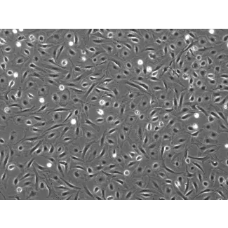 Mouse Pulmonary Alveolar Epithelial Cells (MPAEpiC) - Phase contrast, 100x
