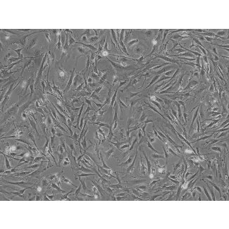 Mouse Pulmonary Fibroblasts (MPF) - Phase contrast, 100x.
