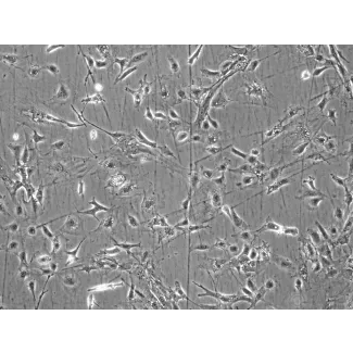 Mouse Renal Mesangial Cells (MRMC) - Phase contrast, 100x.
