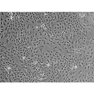 Mouse Renal Proximal Tubular Epithelial Cells (MRPTEpiC) - Phase contrast, 100x.
