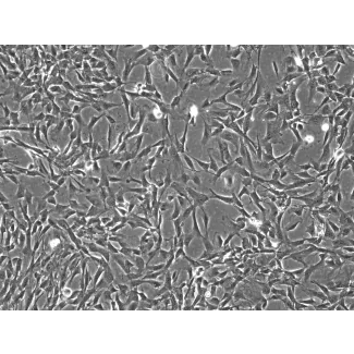 Rabbit Astrocytes (RabA) – Phase Contrast, 100X.
