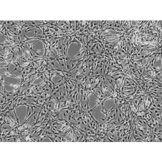 Rat Astrocytes (RA) - Phase contrast, 100x.
