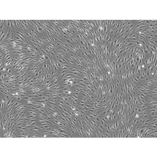 Rat Brain Microvascular Endothelial Cells - Phase contrast, 100x.