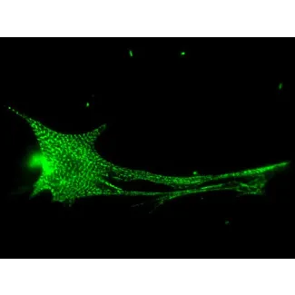 Rat Cardiac Myocytes (RCM) – Immunostaining for Sarcomeric alpha-Actinin (Boster, Cat #MA1104)
