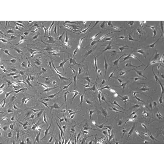Rat Dermal Fibroblasts-adult (RDF-a) - Phase Contrast, 100x.
