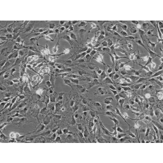 Rat Dermal Fibroblasts (RDF) - Phase contrast, 100x.
