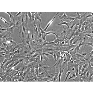 Rat Lens Epithelial Cells (RLEpiC) - Phase contrast, 200x.
