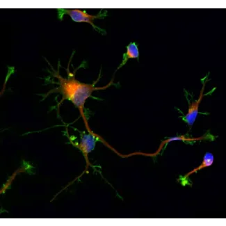 Rat neurons - cortical (R1520) - Immunostaining for Beta Tubulin III (red) and F-actin (green), 600x